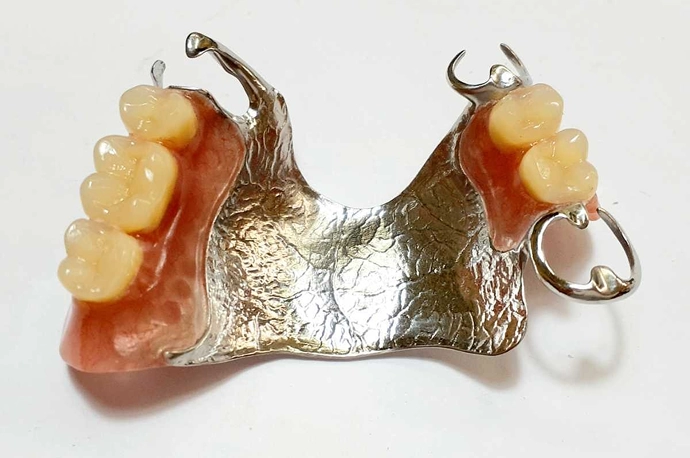 治療用入れ歯で口腔内の正常化