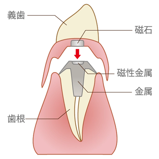 磁性アタッチメント