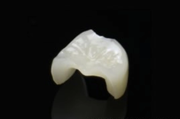 e-maxセラミック