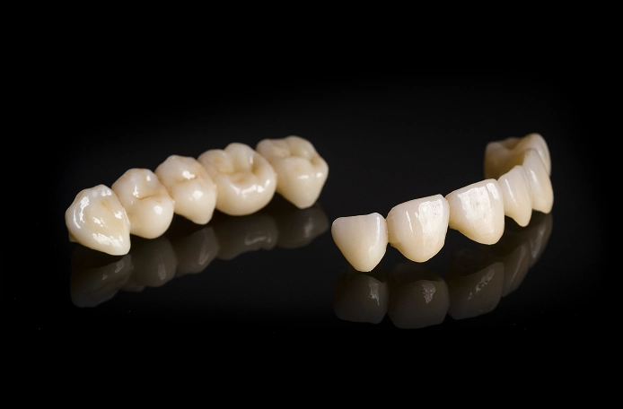 フルジルコニアクラウン