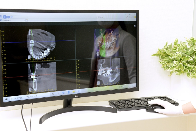 シミュレーションシステム